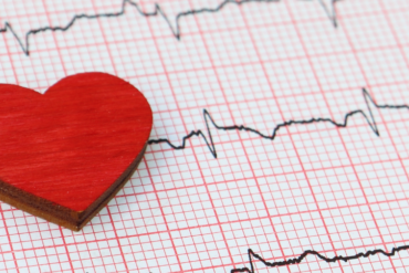 „Herzrasen ohne Ursache: Warum dein Körper reagiert, obwohl alles in Ordnung ist“